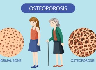 OSTEOPOROSIS: APA SAJA FAKTOR RISIKONYA?