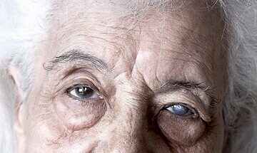 10—16 Maret 2024: PEKAN GLAUKOMA SEDUNIA