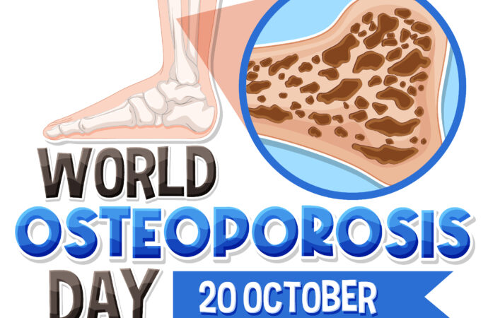 20 Oktober – Hari Osteoporosis Sedunia: Yuk, Kuatkan Tulang Mulai Sekarang!